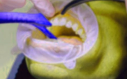 拔牙記作文(精選95篇)