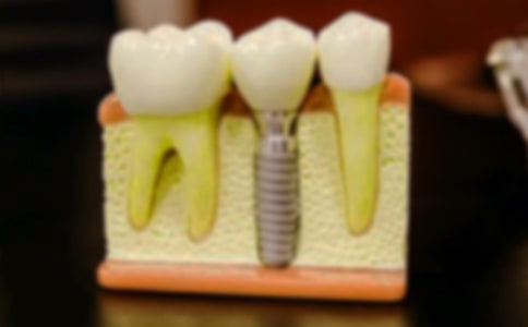 ����ӛ���ġ����T��